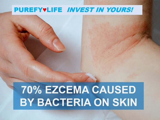 PUREFY Baby Dermal Eczema Spray 4oz 2 Pack