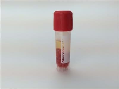 Pro-Lab Diagnostics Microbank Organism Storage System-Red