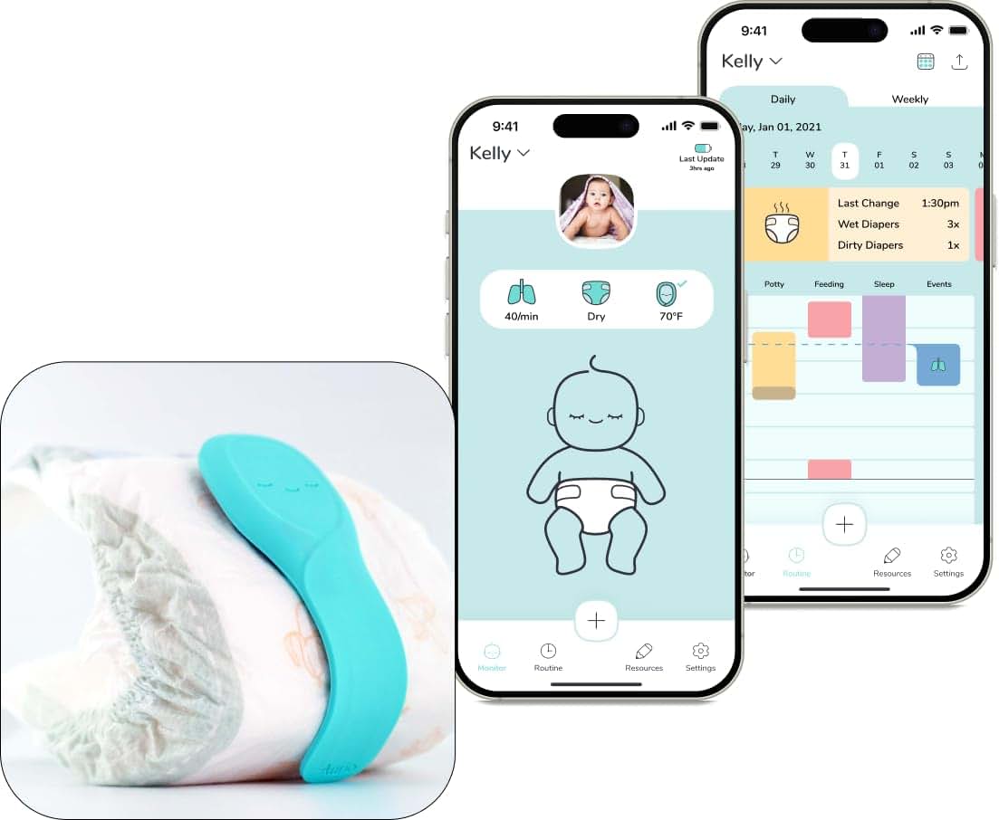 Aurio Smart Baby Monitor – Tracks Breathing, Sleep, Diaper, Temperature with Real-Time Alerts