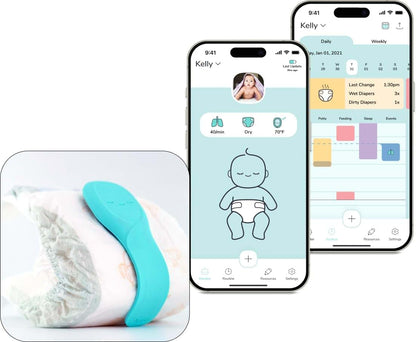 Aurio Smart Baby Monitor – Tracks Breathing, Sleep, Diaper, Temperature with Real-Time Alerts