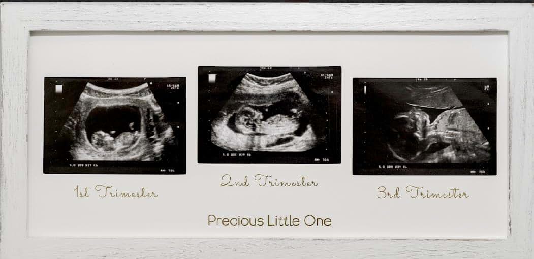 Rustic White Ultrasound Photo Display Frame for Baby Nursery