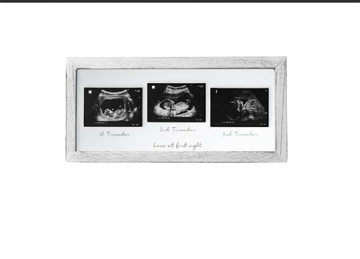 Rustic White Ultrasound Photo Display Frame for Baby Nursery