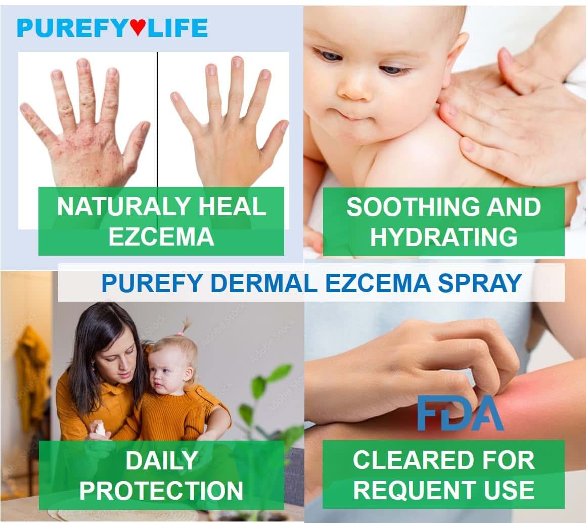 PUREFY Baby Dermal Eczema Spray 4oz 2 Pack