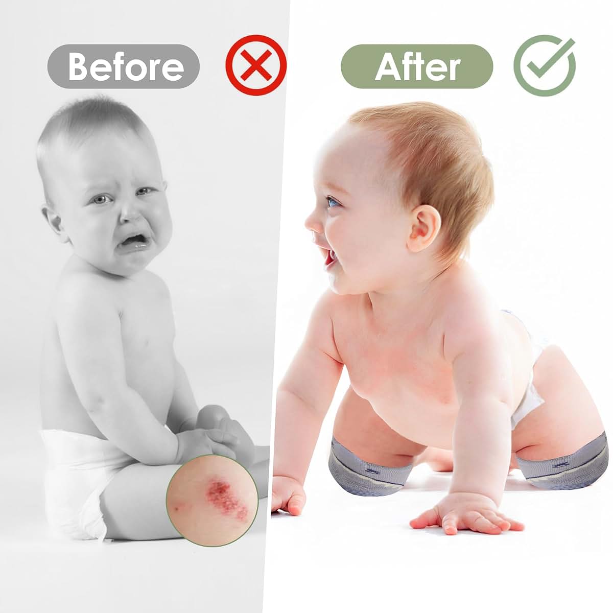 VOLSION Baby Knee Pads for Crawling, 5 Pairs, Toddler