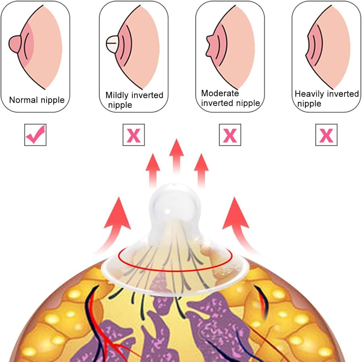 QLJMY Nipple Corrector for Inverted and Flat Nipples, Size L (photo 4)