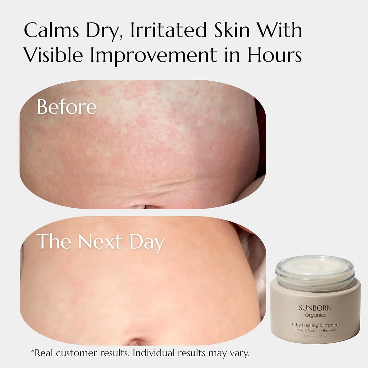 Sunborn Organics Baby Healing Ointment | Natural Moisturizer for Eczema, Irritated & Dry Skin | Made in USA