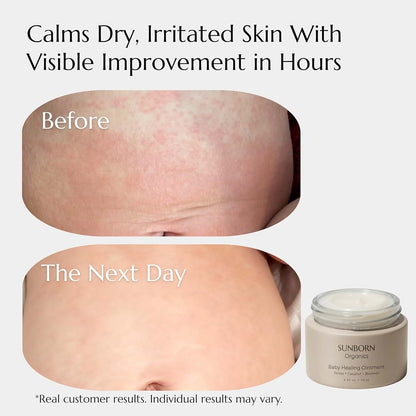 Sunborn Organics Baby Healing Ointment | Natural Moisturizer for Eczema, Irritated & Dry Skin | Made in USA