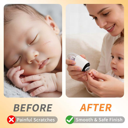 Miraiwatimo Electric Baby Nail Clippers With 3 Speeds And Debris Collector (photo 4)