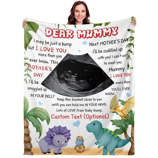 Frrahmen Personalized Baby Ultrasound Blanket - Custom Pregnancy Throw Blanket with Sonogram Photo New Mom Gift for