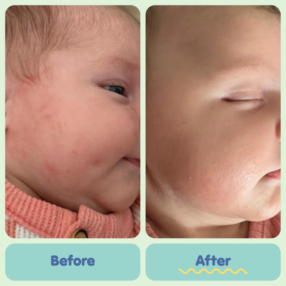 Tubby Todd All Over Ointment - Baby Eczema Cream