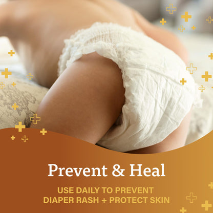 A+D Diaper Rash Ointment 16oz