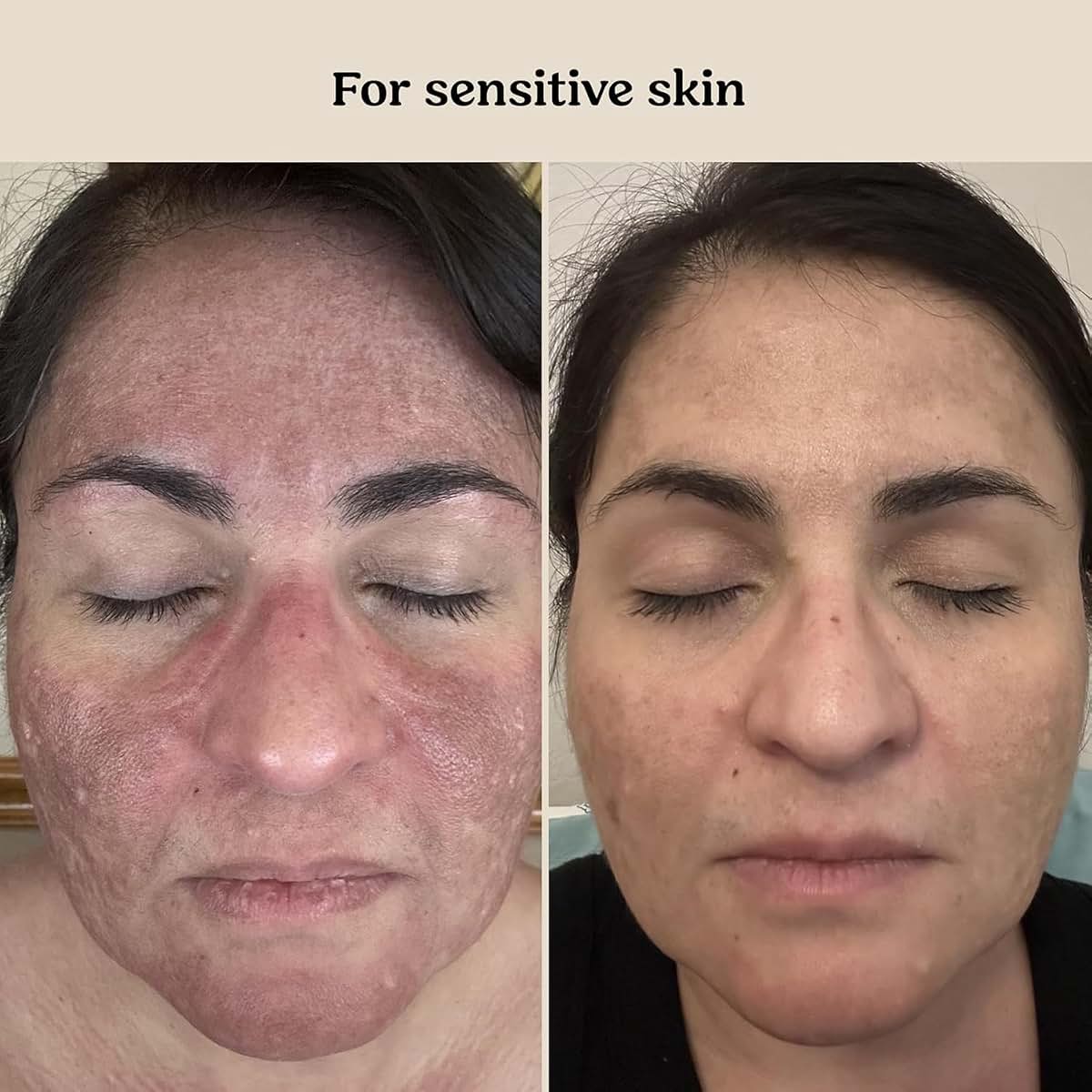 Roe Wellness Baby Cream & Baby Serum Power Pair Biome Barrier | For All Skin & Ages | Hydrating Body, Face, Dry (photo 4)