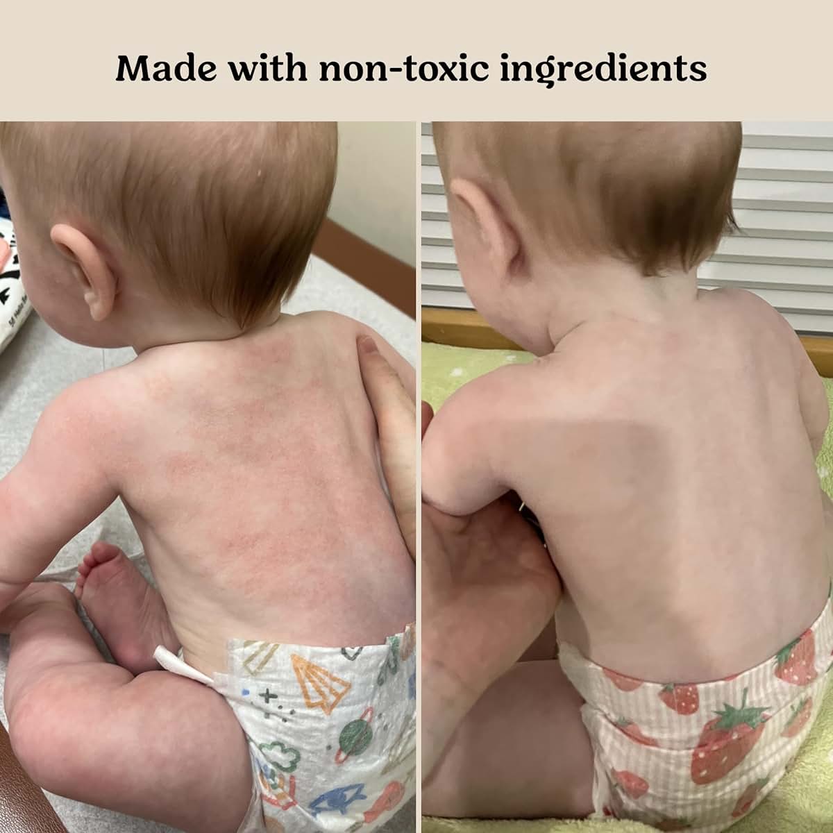 Roe Wellness Baby Cream & Baby Serum Power Pair Biome Barrier | For All Skin & Ages | Hydrating Body, Face, Dry (photo 3)