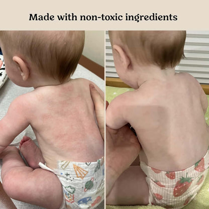 Roe Wellness Baby Cream & Baby Serum Power Pair Biome Barrier | For All Skin & Ages | Hydrating Body, Face, Dry (photo 3)