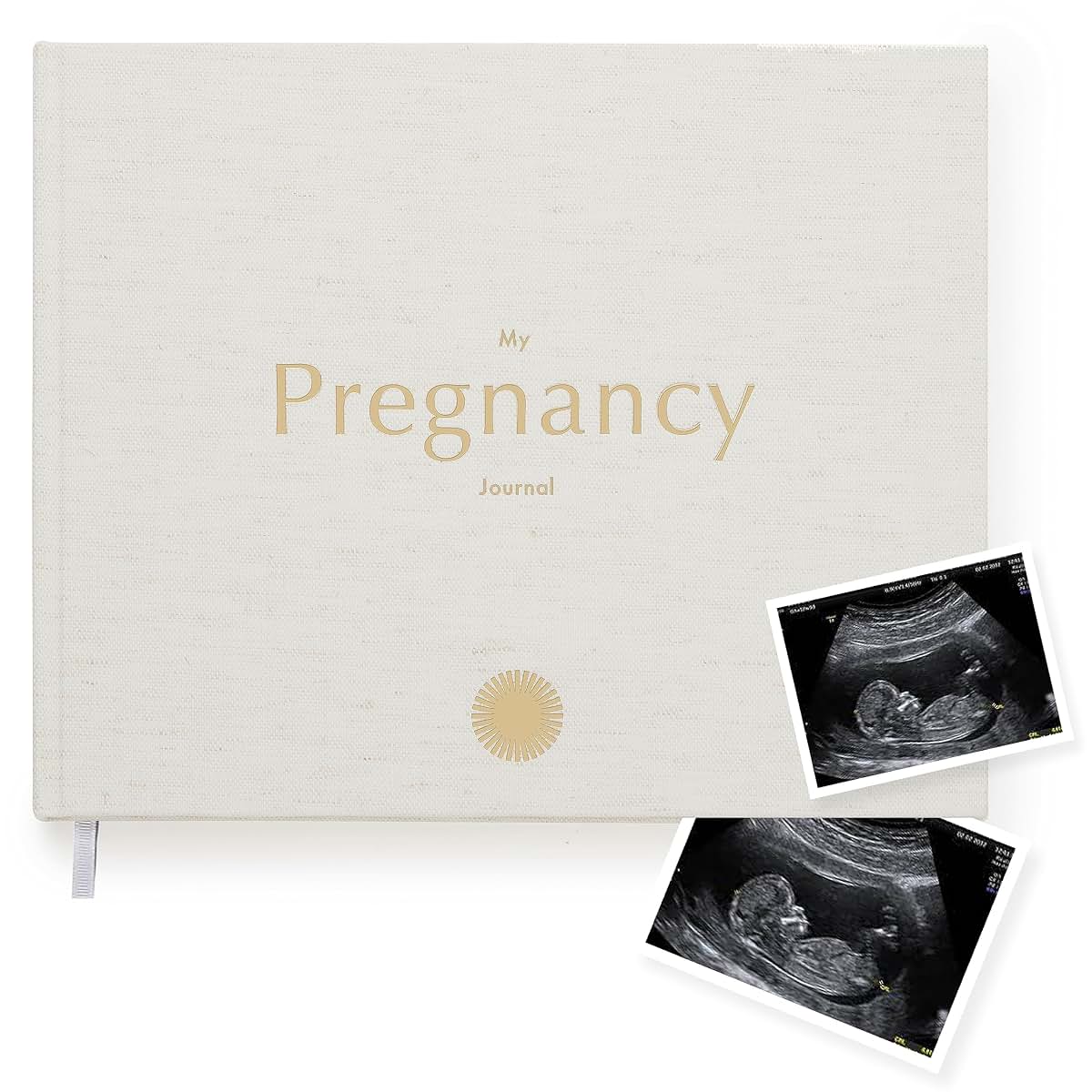 Your Edition Pregnancy Journal - Memory Book for Expecting Mothers